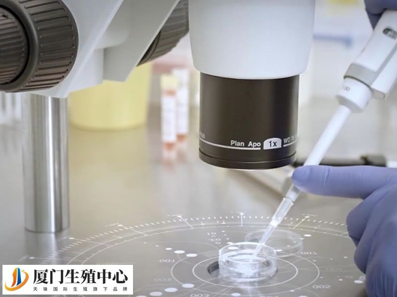 HIV洗精术